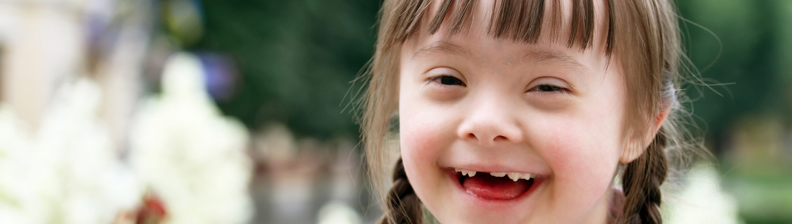 Smiling Disabled Child